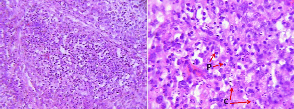 Enfermedad de Gumboro: depleción linfoide y lesiones atróficas, pueden ser inducidas por las vacunas? - Image 7