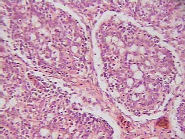 Enfermedad de Gumboro: depleción linfoide y lesiones atróficas, pueden ser inducidas por las vacunas? - Image 11