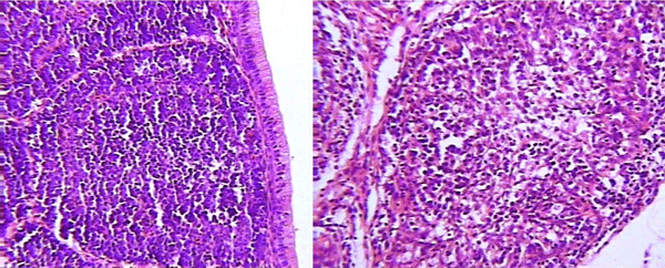 Enfermedad de Gumboro: depleción linfoide y lesiones atróficas, pueden ser inducidas por las vacunas? - Image 3