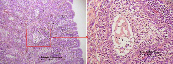 Enfermedad de Gumboro: depleción linfoide y lesiones atróficas, pueden ser inducidas por las vacunas? - Image 8