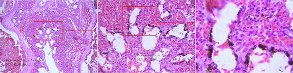 Antracosis. Las aves comerciales, un indicador biológico? - Image 2