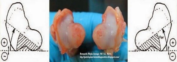 Varus y valgus. Deformación de la articulación intertarsal. Manejo? Genética? - Image 8