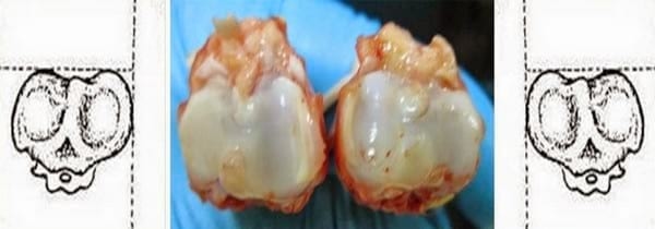 Varus y valgus. Deformación de la articulación intertarsal. Manejo? Genética? - Image 12