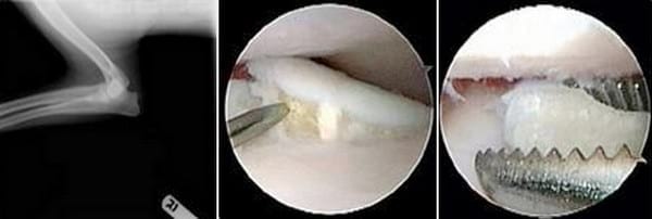 Proceso coronoides medial fragmentado traumático, Parte 1: Diagnóstico. - Image 1