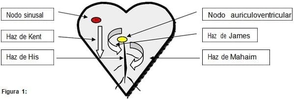 Vías aurículoventricular accesorias en perros y gatos que producen preexcitación ventricular. - Image 1