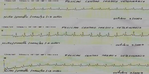 Vías aurículoventricular accesorias en perros y gatos que producen preexcitación ventricular. - Image 4