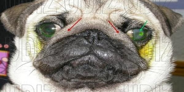 ENTROPION POR PLIEGUE FACIAL - Image 1