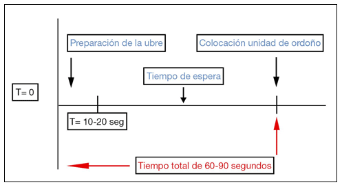 Rutina de ordeño: ¿Cuándo y cómo deben colocarse y retirarse las pezoneras (1ª parte) - Image 4