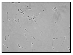 Utilización de momentos estadísticos y redes neuronales en la clasificación de cabezas de espermatozoides de verraco - Image 1