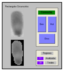 Utilización de momentos estadísticos y redes neuronales en la clasificación de cabezas de espermatozoides de verraco - Image 9