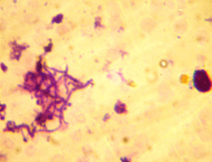Epidemiología de la Dermatofilosis en la Republica de Eritrea - Image 10