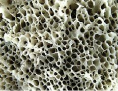 Metabolismo de la vitamina D - Image 5