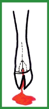 Manual de anestesias y cirugías de bovinos: Sedación, analgesia y anestesia - Image 33