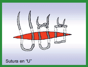 Manual de anestesias y cirugías de bovinos: Cirugías de Abdomen - Image 14