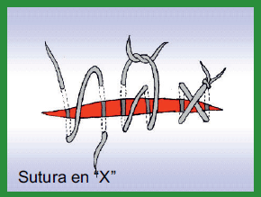 Manual de anestesias y cirugías de bovinos: Cirugías de Abdomen - Image 12