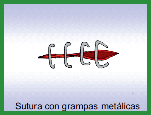 Manual de anestesias y cirugías de bovinos: Cirugías de Abdomen - Image 13