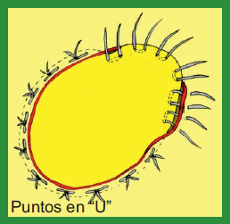 Manual de anestesias y cirugías de bovinos: Cirugías de Abdomen - Image 61