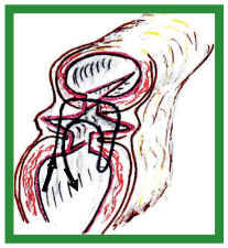 Manual de anestesias y cirugías de bovinos: Cirugías del aparato reproductor de la hembra - Image 25
