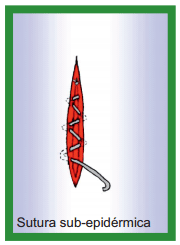 Manual de anestesias y cirugías de bovinos: Cirugías del aparato reproductor de la hembra - Image 22