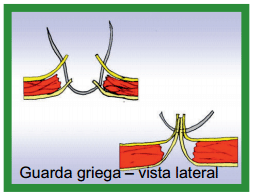 Manual de anestesias y cirugías de bovinos: Cirugías del aparato reproductor de la hembra - Image 10