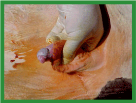 Manual de anestesias y cirugías de bovinos: Cirugías aparato reproductor del macho - Image 36
