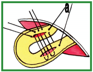 Manual de anestesias y cirugías de bovinos: Cirugías aparato reproductor del macho - Image 6