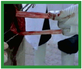 Manual de anestesias y cirugías de bovinos: Cirugías aparato reproductor del macho - Image 2
