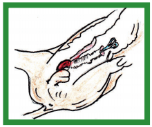 Manual de anestesias y cirugías de bovinos: Cirugías aparato reproductor del macho - Image 13