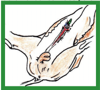 Manual de anestesias y cirugías de bovinos: Cirugías aparato reproductor del macho - Image 10