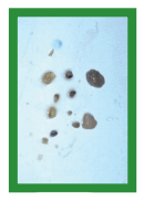 Manual de anestesias y cirugías de bovinos: Cirugías de los pezones - Image 16
