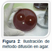 Contaminación de carne de ave con C. jejuni resistente a los antibióticos a la venta en supermercados chilenos. - Image 3