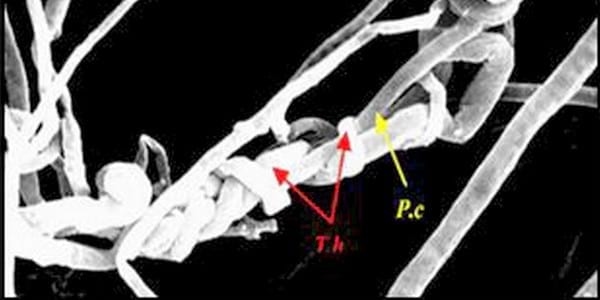 Trichoderma harzianum como agente de control biológico - Image 6