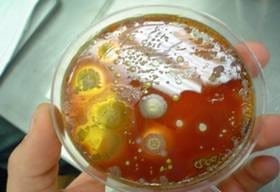 La Mastitis y sus pruebas diagnosticas en Campo - Image 6