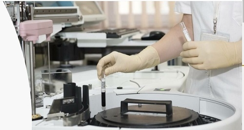 Agrimprove confirma científicamente la capacidad de fijación de endotoxinas mediante un estudio ex vivo - Image 1
