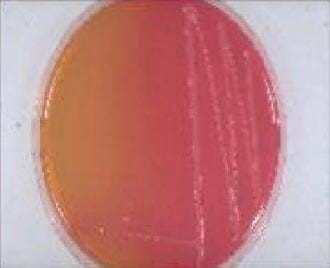 Evaluación comparativa de la efectividad antibiótica del Tylo – Combisone® (tilosina+gentamicina) y Proxifen® 23 L.A.(oxitetraciclina) contra cepas bacterianas causantes de enfermedad respiratoria en bovinos - Image 17