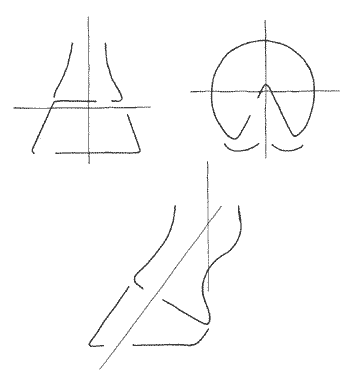 El pie ideal que tanto se busca - Image 1