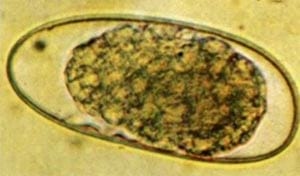 Efectos del parasitismo gastrointestinal sobre la nutrición en vacunos - Image 1