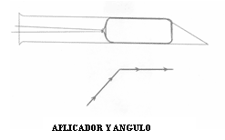 Esponja vaginal, Un poco más... - Image 2