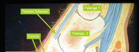 Cuando su negocio cojea - Image 1