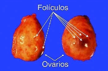 Descripción de los diferentes estados en vacas vacías - Image 2