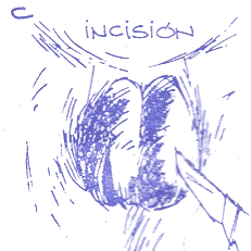 Técnicas de castración del cerdo - Image 4