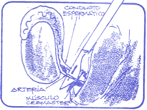 Técnicas de castración del cerdo - Image 11