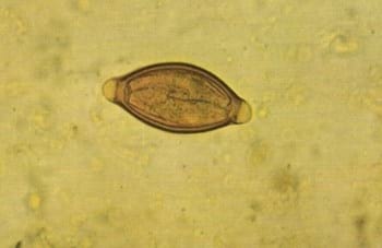 Enfermedades parasitarias gastrointestinales y pulmonares de bovinos, ovinos y caprinos - Image 7