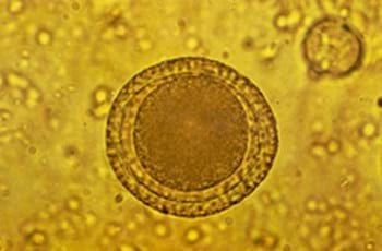 Enfermedades parasitarias gastrointestinales y pulmonares de bovinos, ovinos y caprinos - Image 1