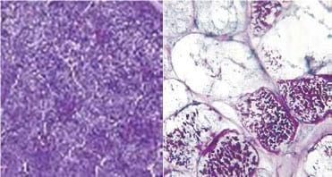 Investigadores determinan Causas genéticas para el Síndrome del Potrillo contraído - Image 4