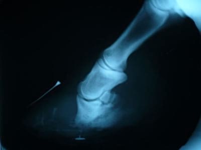 Laminitis: Un Evento Catastrófico - Image 6