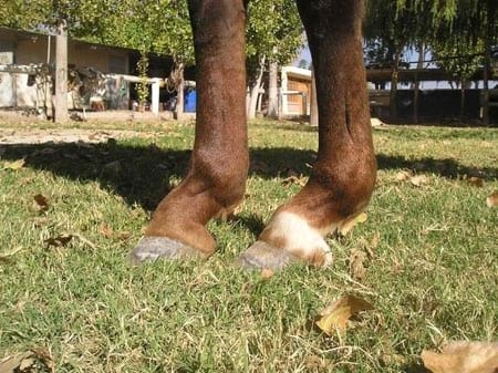 Desmosis del ligamento suspensor del nudo - Image 5