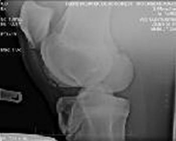 Osteocondrosis en Equinos - Image 4