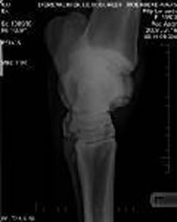 Osteocondrosis en Equinos - Image 2