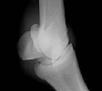 Osteocondrosis en Equinos - Image 3